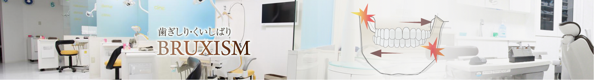 歯ぎしり・くいしばり