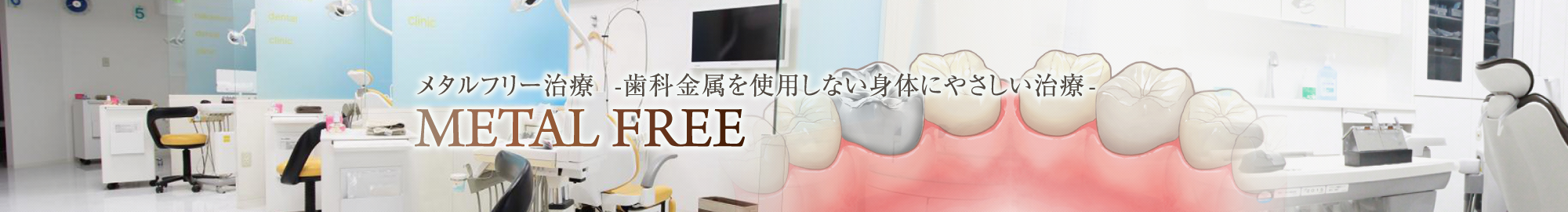 メタルフリー治療 -歯科金属を使用しない身体にやさしい治療-